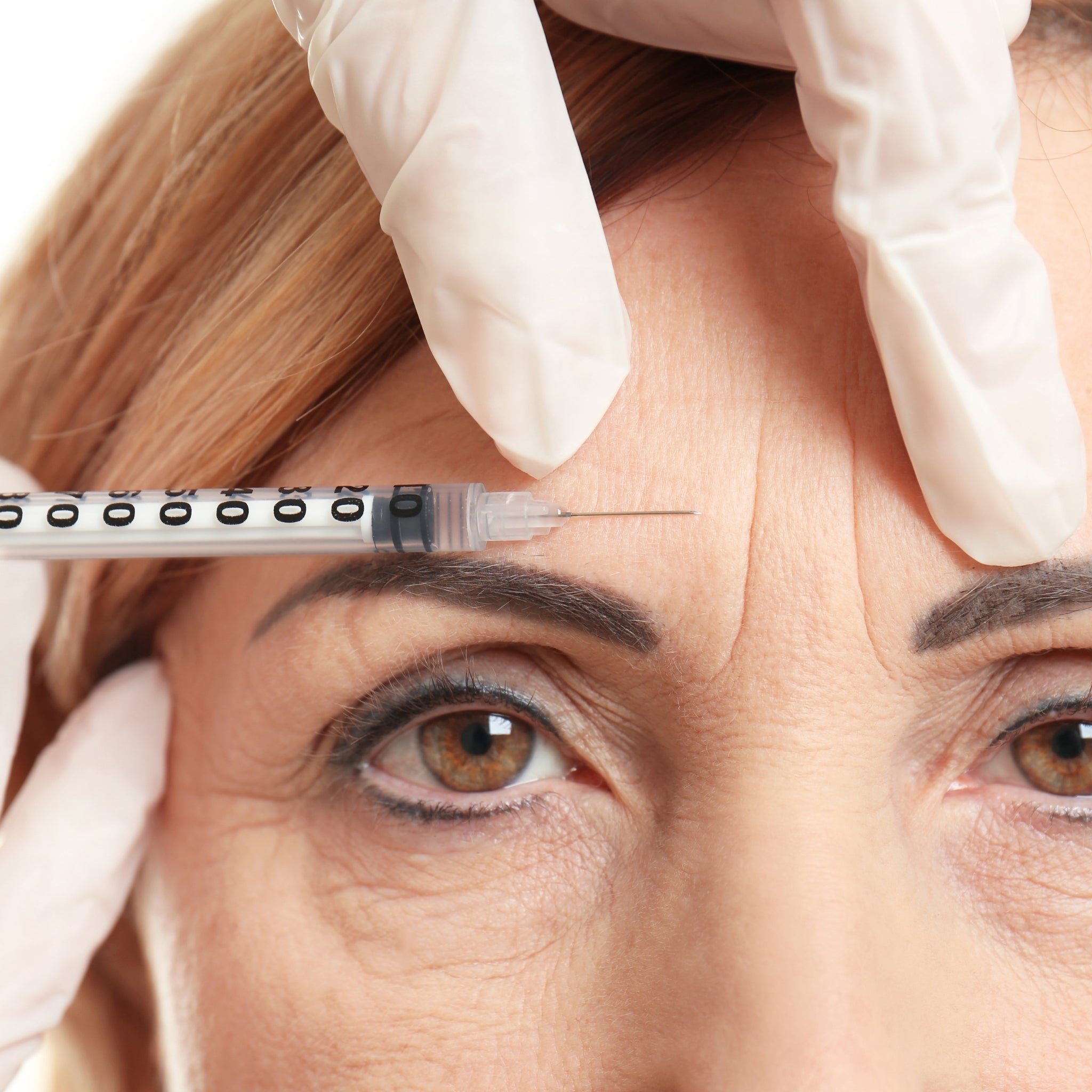 Botox alternative skincare in your 40s — natural anti-aging ingredients that replace Botox for women